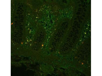 TNF alpha Antibody