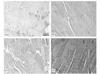 TNF alpha Antibody