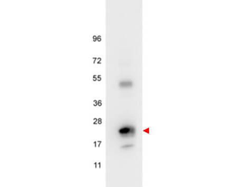 IL-6 Antibody