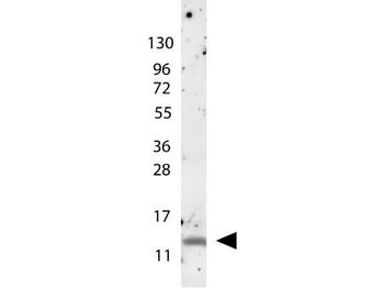 MIP-1 beta Antibody