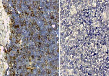 TF Antibody