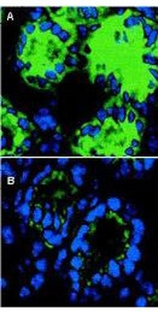 IL-18 Antibody