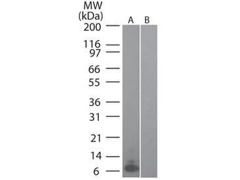 MIP-3 alpha Antibody