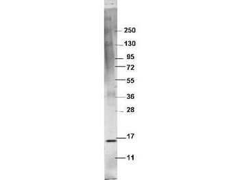 TNF alpha Antibody