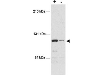 MTBP Antibody