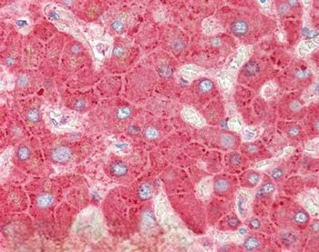 APOLIPOPROTEIN C-III Antibody