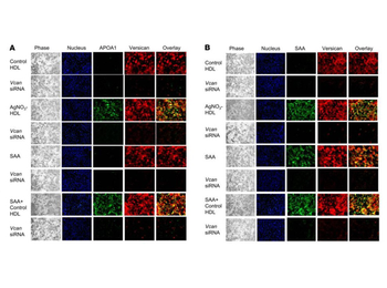 Apolipoprotein A-I Antibody