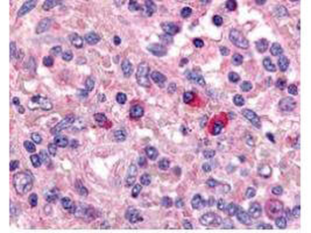ARTEMIS Antibody