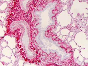 Collagen Type I Antibody