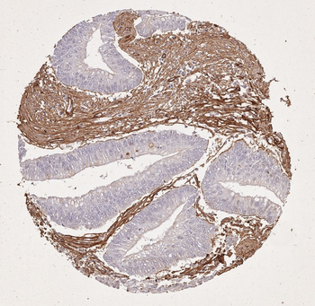 Collagen Type I Antibody