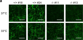 Collagen Type I Antibody
