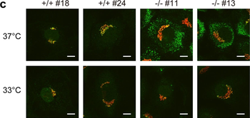 Collagen Type I Antibody