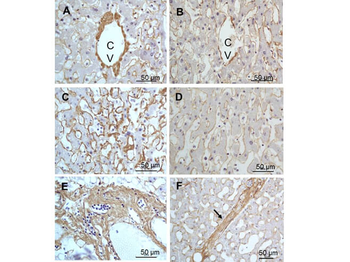 Collagen Type III Antibody