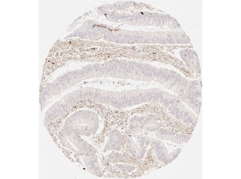 Collagen Type III Antibody