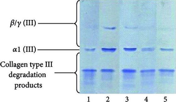 Collagen Type III Antibody