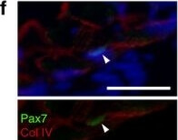 Collagen Type IV Antibody