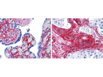 Collagen Type VI Antibody