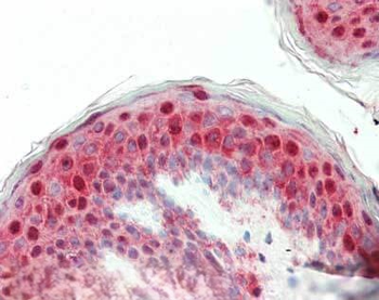 LAMA1/LAMB1 Antibody