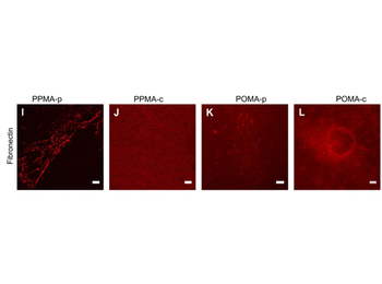 Fibronectin Antibody