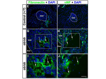 Fibronectin Antibody