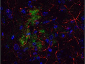Beta Amyloid Antibody