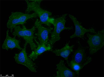 Beta Amyloid Antibody
