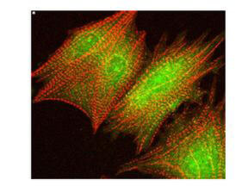AKT phospho S473 Antibody