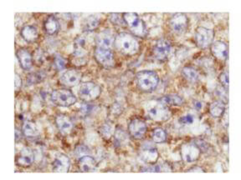 AKT phospho S473 Antibody
