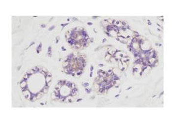 AKT phospho S473 Antibody