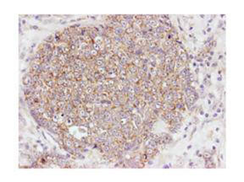 AKT phospho S473 Antibody