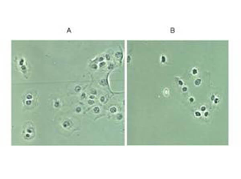 RELA Antibody