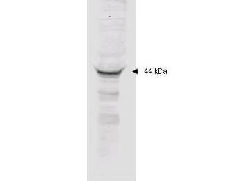 MAPKAPK2 Antibody