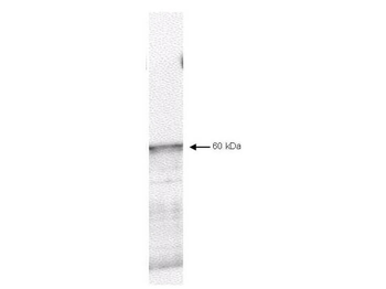 PDK1 Antibody