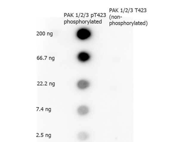 PAK 1/2/3 phospho T423 Antibody