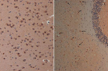 Nestin Antibody
