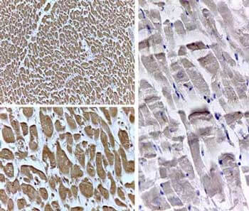 PPAR delta Antibody