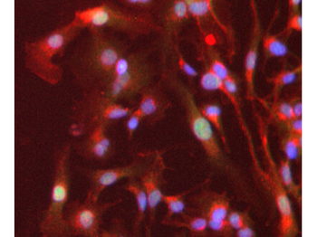 PPAR alpha Antibody