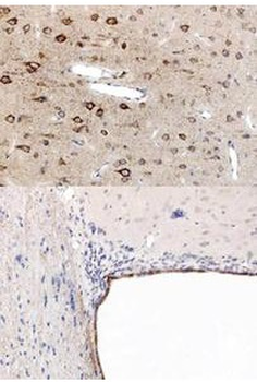 PPAR alpha Antibody