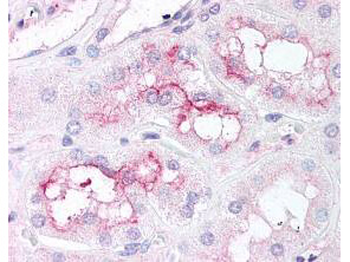 mTOR phospho S2448 Antibody