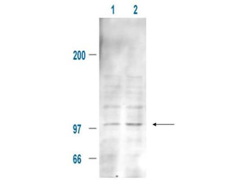 Mdm2 phospho S185 Antibody