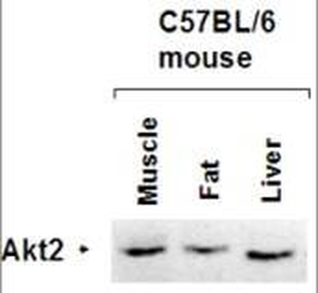 AKT2 Antibody