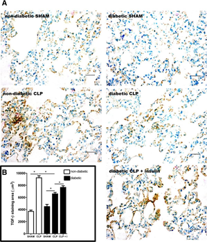 TGF beta 1 Antibody