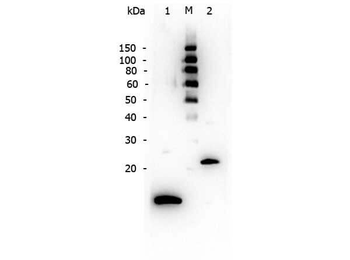 TGF beta 1 Antibody