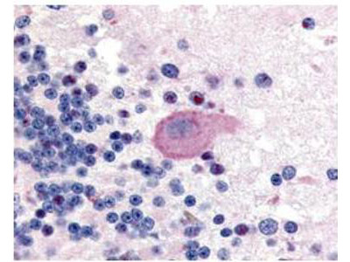 Huntington phospho S421 Antibody