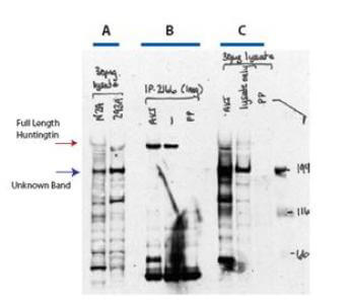 Huntington phospho S421 Antibody