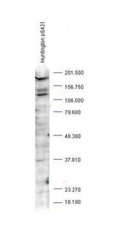 Huntington phospho S421 Antibody