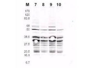 RFA2 phospho S122 Antibody