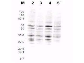 RFA2 Antibody