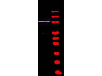 BRIP1 Antibody