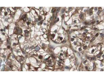 MAD2L2 Antibody